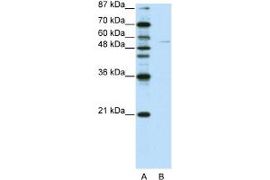 WB Suggested Anti-GRHL3 Antibody Titration:  0. (GRHL3 anticorps  (C-Term))