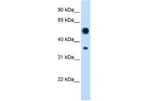 ASL antibody used at 0. (ASL anticorps  (N-Term))