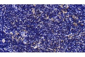 Detection of MAP2K4 in Rat Thymus Tissue using Polyclonal Antibody to Mitogen Activated Protein Kinase Kinase 4 (MAP2K4)