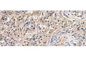 Immunohistochemistry of paraffin-embedded Human brain tissue using SAV1 Polyclonal Antibody at dilution of 1:90(x200)