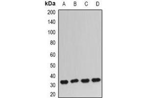 Western blot analysis of IGFBP5 expression in PC3 (A), BT474 (B), mouse kidney (C), mouse lung (D) whole cell lysates. (IGFBP5 anticorps)