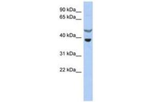Image no. 1 for anti-Suppressor of Cytokine Signaling 7 (SOCS7) (AA 35-84) antibody (ABIN6743758) (SOCS7 anticorps  (AA 35-84))