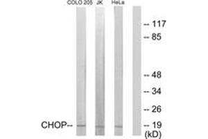 Western blot analysis of extracts from HeLa/Jurkat/COLO205 cells, using CHOP (Ab-30) Antibody. (DDIT3 anticorps  (AA 15-64))