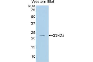 Western blot analysis of the recombinant protein. (IL17 Receptor B anticorps  (AA 166-354))