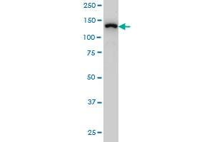 SF3B2 monoclonal antibody (M01), clone 5D2 Western Blot analysis of SF3B2 expression in Hela S3 NE .