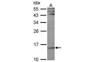 Image no. 1 for anti-Ubiquitin-Conjugating Enzyme E2B (UBE2B) (AA 7-152) antibody (ABIN467405)