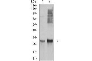 Western blot analysis using HLA-DRA mouse mAb against Ramos (1), and Raji (2) cell lysate. (HLA-DRA anticorps  (AA 26-254))