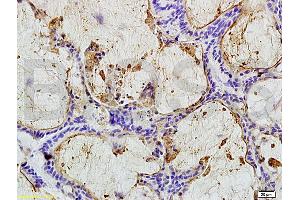 Immunohistochemistry (IHC) image for anti-Carcinoembryonic Antigen Gene Family (CEA) antibody (ABIN722946)