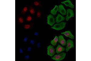 ABIN6255370 and ABIN6267631 staining HepG2 cells(4h of LPS treatment) by IF/ICC. (PRKAA1 anticorps  (pSer486))