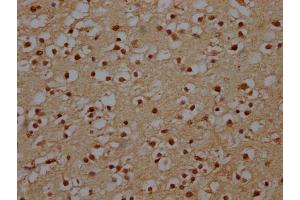 IHC image of ABIN7151088 diluted at 1:140 and staining in paraffin-embedded human brain tissue performed on a Leica BondTM system. (NHLRC1 anticorps  (AA 86-395))