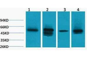 Western Blotting (WB) image for anti-Lactate Dehydrogenase D (LDHD) antibody (ABIN3181365)