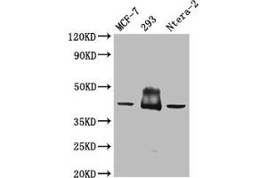 Western Blot Positive WB detected in: Mouse brain tissue All lanes: S1PR2 antibody at 3 μg/mL Secondary Goat polyclonal to rabbit IgG at 1/50000 dilution Predicted band size: 39 kDa Observed band size: 39 kDa (S1PR2 anticorps  (AA 293-353))