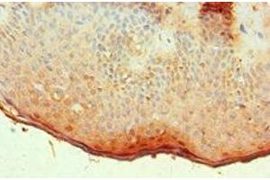 Immunohistochemistry of paraffin-embedded human skin tissue using ABIN7144533 at dilution of 1:100 (ALOX15B anticorps  (AA 1-200))