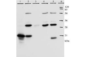 IP analysis of HPV-18 E7 protein. (HPV18 E7 anticorps  (AA 36-70))
