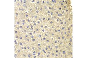 Immunohistochemistry of paraffin-embedded human liver injury using COMT antibody at dilution of 1:200 (400x lens). (COMT anticorps)
