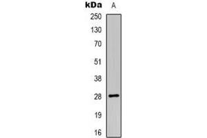 Western blot analysis of HLA-DOA expression in HL60 (A) whole cell lysates. (HLA-DOA anticorps)