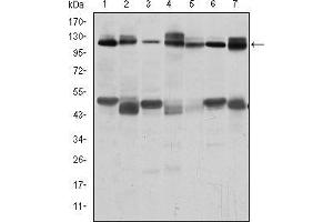 Western blot analysis using C-CBL mouse mAb against RAJI (1), RAW264. (CBL anticorps)