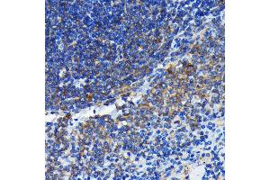 Immunohistochemistry of paraffin-embedded rat spleen using Bax antibody (ABIN7265858) at dilution of 1:100 (40x lens).