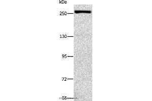 Western blot analysis of Raji cell, using ESPL1 Polyclonal Antibody at dilution of 1:500 (Separase anticorps)
