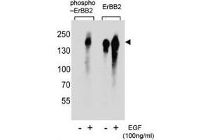 Western blot analysis of extracts from A431 cells, untreated or treated with EGF, using phospho-ERBB2 antibody (left) or nonphos Ab (right). (ErbB2/Her2 anticorps  (pTyr1005))