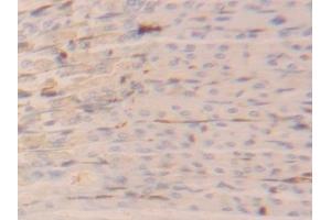 Detection of FABP4 in Mouse Stomach Tissue using Polyclonal Antibody to Fatty Acid Binding Protein 4 (FABP4)