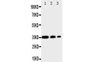 Anti-CD163 antibody, Western blottingAll lanes: Anti CD163  at 0. (CD163 anticorps  (AA 1056-1165))