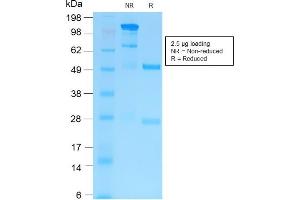 SDS-PAGE Analysis of Purified MMP9 Rabbit Recombinant Monoclonal Antibody (MMP9/2025R).