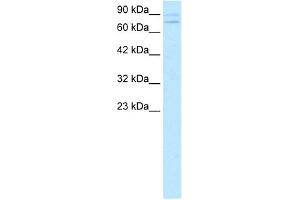 WB Suggested Anti-ZNF81 Antibody Titration:  0. (ZNF81 anticorps  (Middle Region))