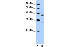 WB Suggested Anti-GPR161 Antibody Titration:  5. (GPR161 anticorps  (C-Term))