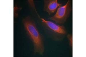 Immunofluorescence staining of methanol-fixed HeLa cells using IKK-β (Ab-199) Antibody (E021305, Red) (IKBKB anticorps)