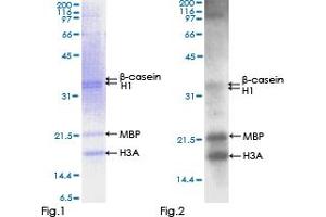 Western Blotting (WB) image for PTK2 Protein tyrosine Kinase 2 (PTK2) (AA 1-680) protein (GST tag) (ABIN1316775)