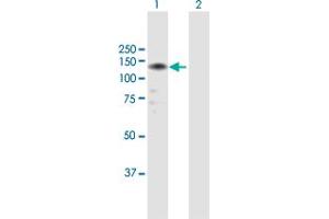 Western Blot analysis of LLGL2 expression in transfected 293T cell line by LLGL2 MaxPab polyclonal antibody. (LLGL2 anticorps  (AA 1-1020))