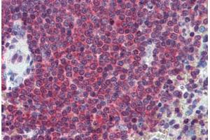 Human Spleen: Formalin-Fixed, Paraffin-Embedded (FFPE) (CA1 anticorps  (AA 166-176))