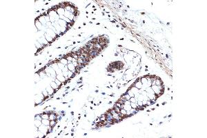 Immunohistochemistry of paraffin-embedded human colon using HMGB2 Rabbit mAb (ABIN7267649) at dilution of 1:100 (40x lens). (HMGB2 anticorps)