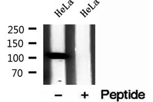 Western blot analysis of extracts of HeLa cells, using IPO4 antibody. (Importin 4 anticorps  (Internal Region))