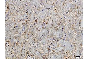 Formalin-fixed and paraffin embedded rat myocardium tissue labeled with Anti-Bcl-2 Polyclonal Antibody, Unconjugated (ABIN723920) 1:300 followed by conjugation to the secondary antibody and DAB staining