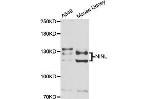 Western blot analysis of extracts of A549 and mouse kidney cell lines, using NINL antibody. (NINL anticorps)