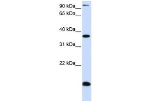 WB Suggested Anti-KLF8 Antibody Titration: 0. (KLF8 anticorps  (N-Term))