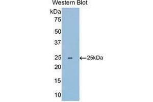 Western Blotting (WB) image for anti-Slit Homolog 1 (SLIT1) (AA 3-211) antibody (ABIN1176119)