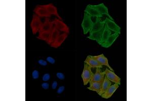 ABIN6266193 and ABIN6277347 staining Hela cells(30 min of UV treatment) by IF/ICC.