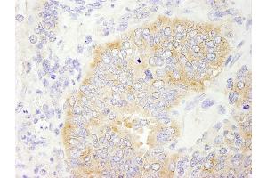 Immunohistochemistry (IHC) image for anti-eIF2beta/EIF2S2 (AA 283-333) antibody (ABIN7448545) (eIF2beta/EIF2S2 (AA 283-333) anticorps)