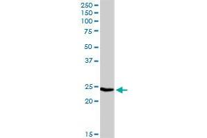 IGLL1 MaxPab rabbit polyclonal antibody. (IGLL1 anticorps  (AA 1-213))