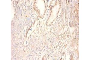 Immunohistochemistry of paraffin-embedded human prostate tissue using ABIN7148667 at dilution of 1:100 (CKMT1A anticorps  (AA 40-417))