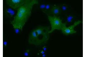 Anti-MOBKL2B mouse monoclonal antibody (ABIN2453319) immunofluorescent staining of COS7 cells transiently transfected by pCMV6-ENTRY MOBKL2B (RC205977). (MOBKL2B anticorps)