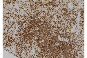 ABIN6276576 at 1/100 staining Rat spleen tissue by IHC-P. (CDC25A anticorps  (N-Term))