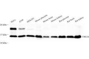 Western blot analysis of UBE2A (ABIN7075356) at dilution of 1: 500 (Rad6 anticorps)