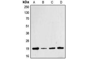 Western blot analysis of Cofilin (pS3) expression in Jurkat (A), HeLa (B), MCF7 (C), A431 (D) whole cell lysates.