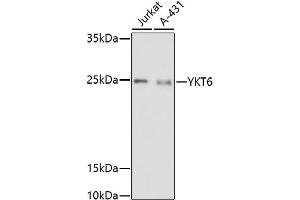 Western blot analysis of extracts of various cell lines, using YKT6 antibody (ABIN7271424) at 1:1000 dilution. (YKT6 anticorps)