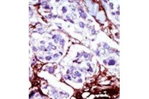 Image no. 2 for anti-Cytidine Monophosphate (UMP-CMP) Kinase 1, Cytosolic (CMPK1) (C-Term) antibody (ABIN360614)