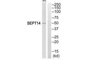 Western blot analysis of extracts from NIH/3T3 cells, using SEPT14 antibody. (Septin 14 anticorps  (C-Term))